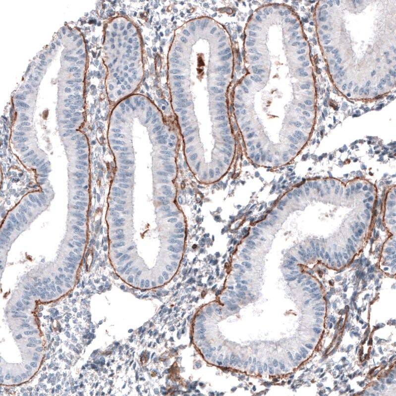 Laminin gamma 1 Antibody (CL3196) Immunohistochemistry: Laminin gamma 1 Antibody (CL3196) [NBP3-52468]