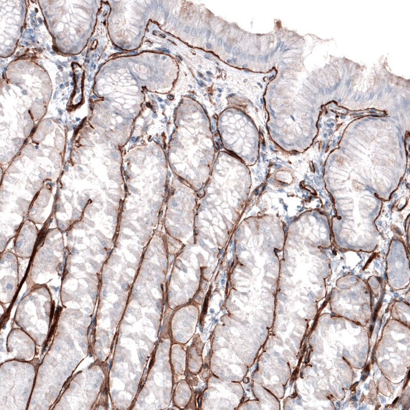 Laminin gamma 1 Antibody (CL3196) Immunohistochemistry: Laminin gamma 1 Antibody (CL3196) [NBP3-52468]