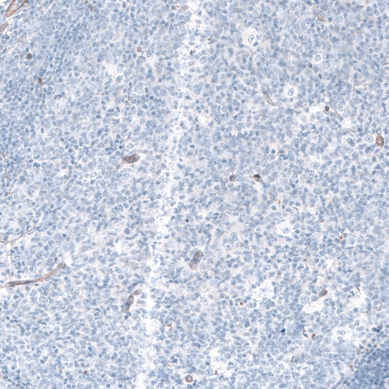 Laminin gamma 1 Antibody (CL3196) Immunohistochemistry: Laminin gamma 1 Antibody (CL3196) [NBP3-52468]