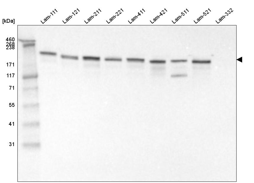 Laminin gamma 1 Antibody (CL3196) Western Blot: Laminin gamma 1 Antibody (CL3196) [NBP3-52468]