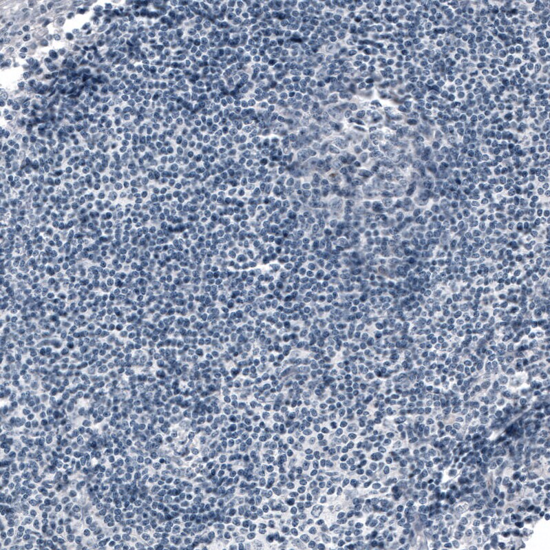 ACE-2 Antibody (CL4035) Immunohistochemistry: ACE-2 Antibody (CL4035) [NBP3-52474]