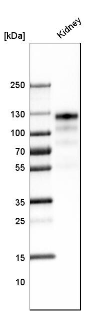 ACE-2 Antibody (CL4035) Western Blot: ACE-2 Antibody (CL4035) [NBP3-52474]