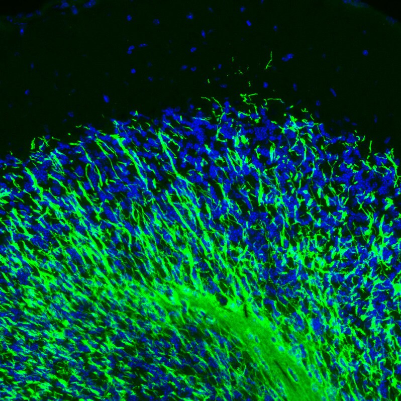 MBP Antibody (CL2829) Immunohistochemistry: MBP Antibody (CL2829) [NBP3-52461]