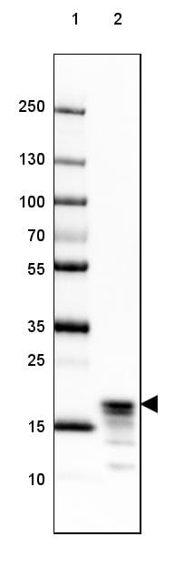 MBP Antibody (CL2829) Western Blot: MBP Antibody (CL2829) [NBP3-52461]