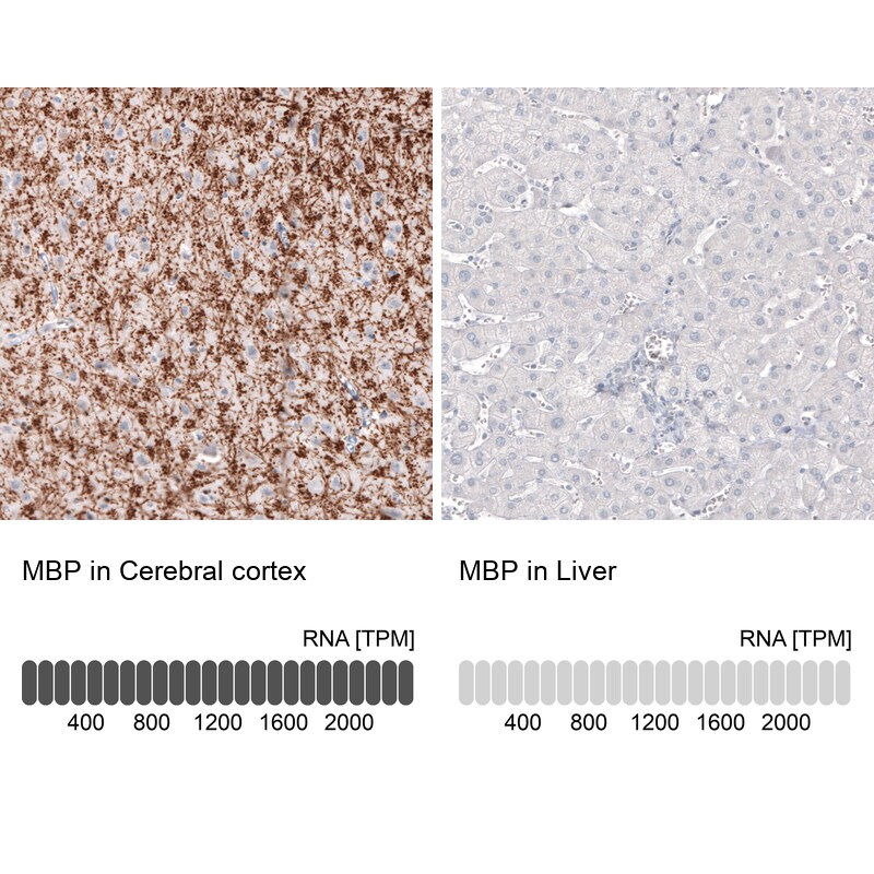 MBP Antibody (CL2829) Immunohistochemistry: MBP Antibody (CL2829) [NBP3-52088]
