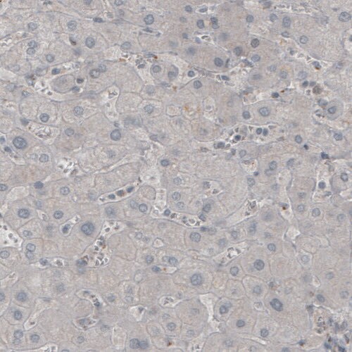 MOG Antibody (CL2852) Immunohistochemistry: MOG Antibody (CL2852) [NBP3-52462]