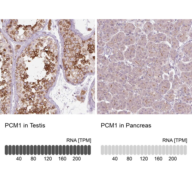 PCM1 Antibody (CL0206) Immunohistochemistry: PCM1 Antibody (CL0206) [NBP3-52444]