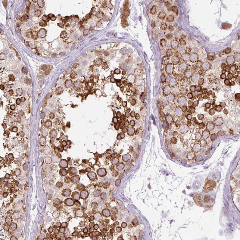 PCM1 Antibody (CL0206) Immunohistochemistry: PCM1 Antibody (CL0206) [NBP3-52444]