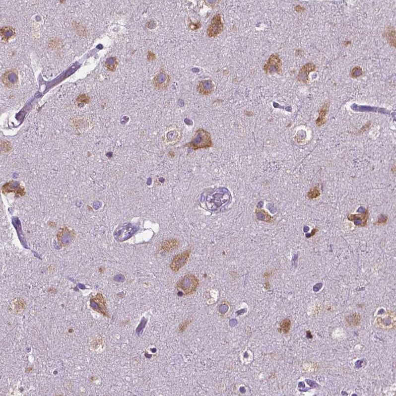 Dicer Antibody (CL0378) Immunohistochemistry: Dicer Antibody (CL0378) [NBP3-52092]