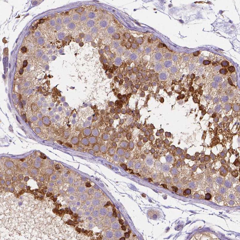 Dicer Antibody (CL0378) Immunohistochemistry: Dicer Antibody (CL0378) [NBP3-52092]