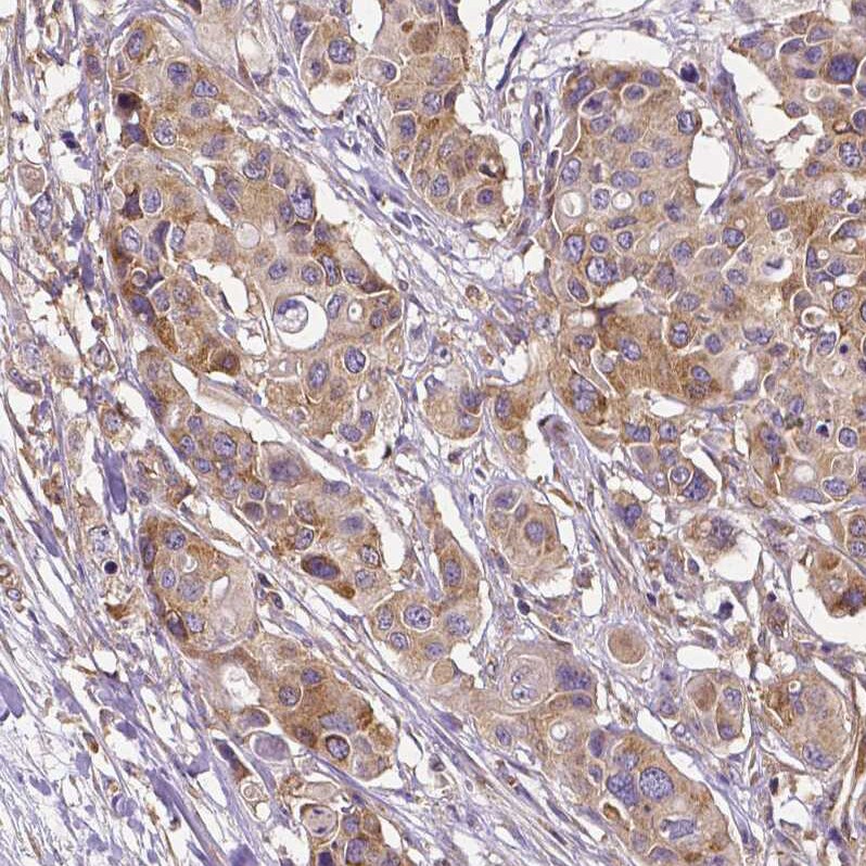 Dicer Antibody (CL0378) Immunohistochemistry: Dicer Antibody (CL0378) [NBP3-52092]