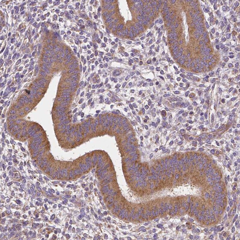 Dicer Antibody (CL0378) Immunohistochemistry: Dicer Antibody (CL0378) [NBP3-52092]