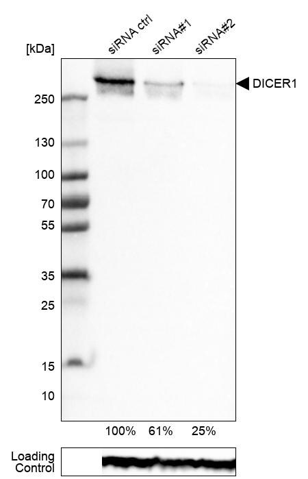Dicer Antibody (CL0378) Western Blot: Dicer Antibody (CL0378) [NBP3-52092]