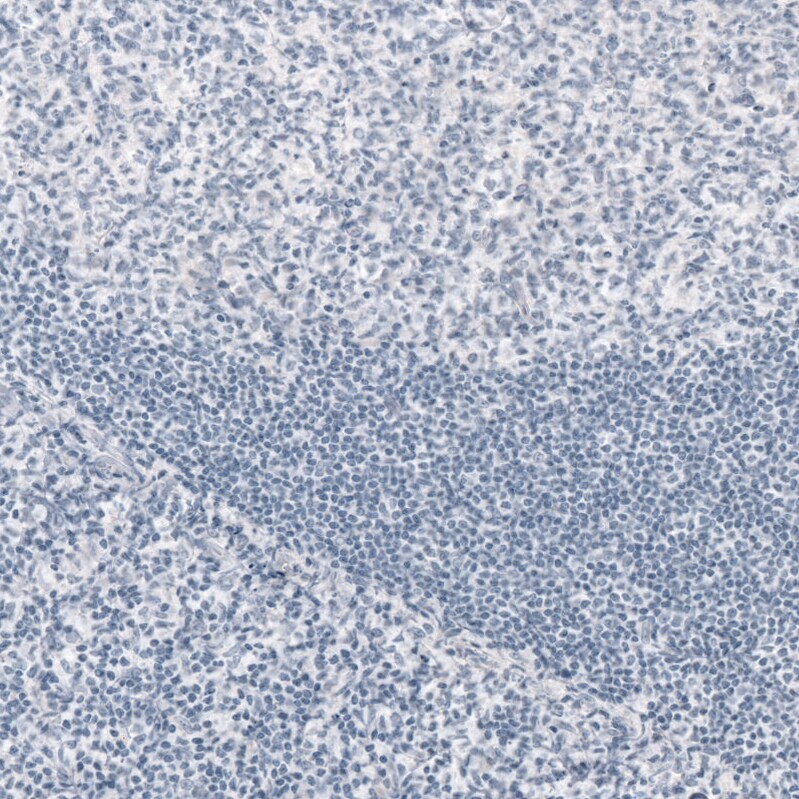 GFAP Antibody (CL2713) Immunohistochemistry: GFAP Antibody (CL2713) [NBP3-52487]