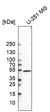 GFAP Antibody (CL2713) Western Blot: GFAP Antibody (CL2713) [NBP3-52487]