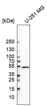 GFAP Antibody (CL2713) Western Blot: GFAP Antibody (CL2713) [NBP3-52093]