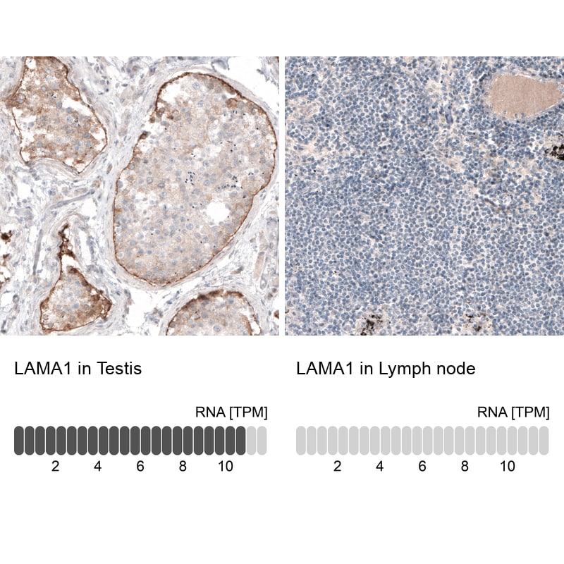 Laminin alpha 1 Antibody (CL3087) Immunohistochemistry: Laminin alpha 1 Antibody (CL3087) [NBP3-52488]