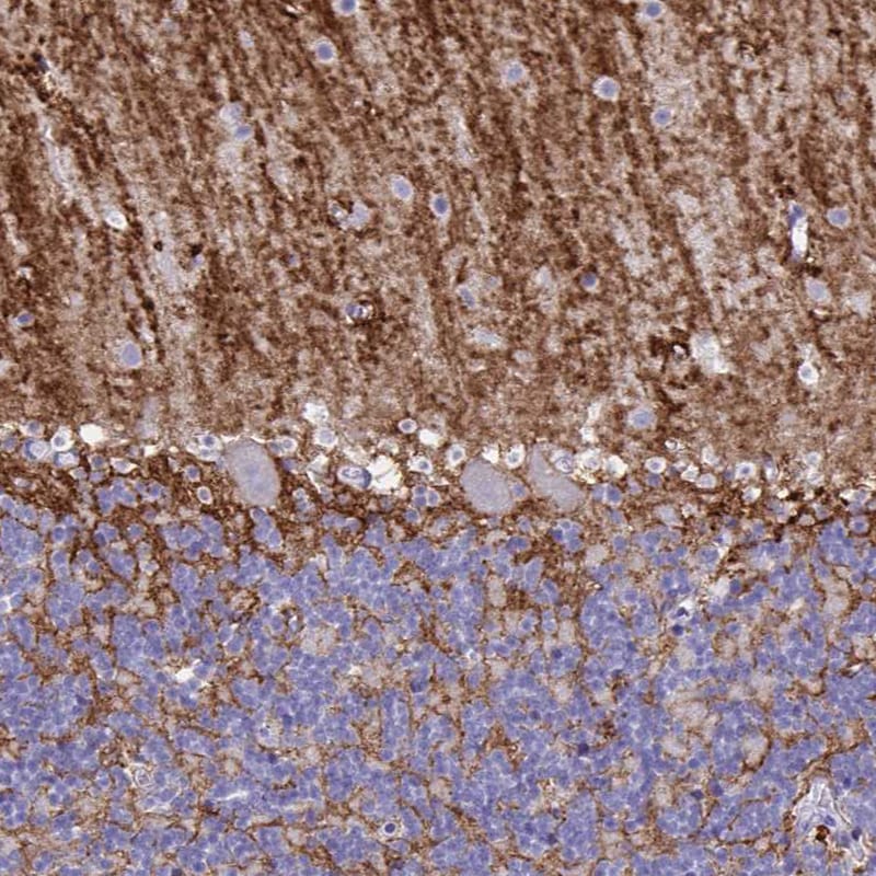 Aquaporin-4 Antibody (CL0178) Immunohistochemistry: Aquaporin-4 Antibody (CL0178) [NBP3-52443]