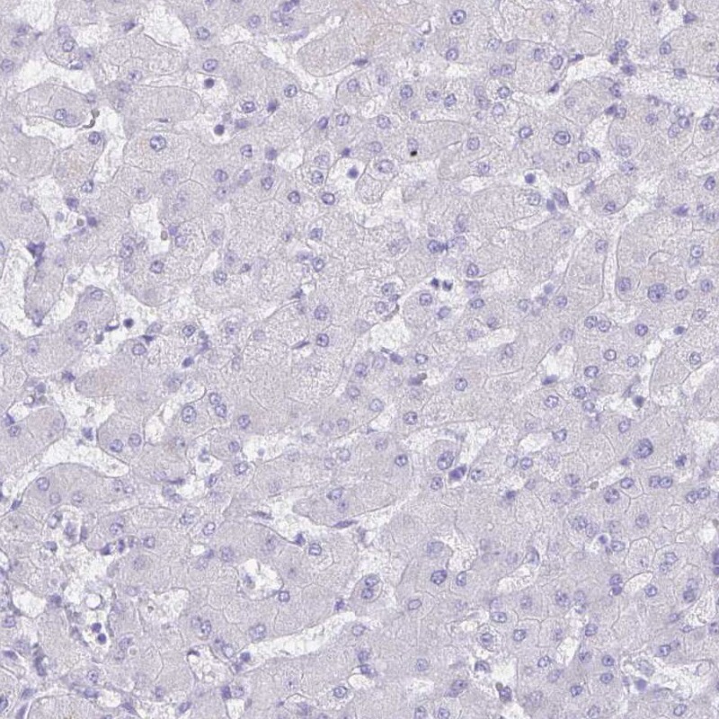 Aquaporin-4 Antibody (CL0178) Immunohistochemistry: Aquaporin-4 Antibody (CL0178) [NBP3-52443]