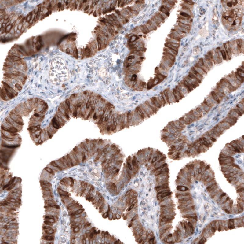HMG-CoA Reductase/HMGCR Antibody (CL0259) Immunohistochemistry: HMG-CoA Reductase/HMGCR Antibody (CL0259) [NBP3-52446]