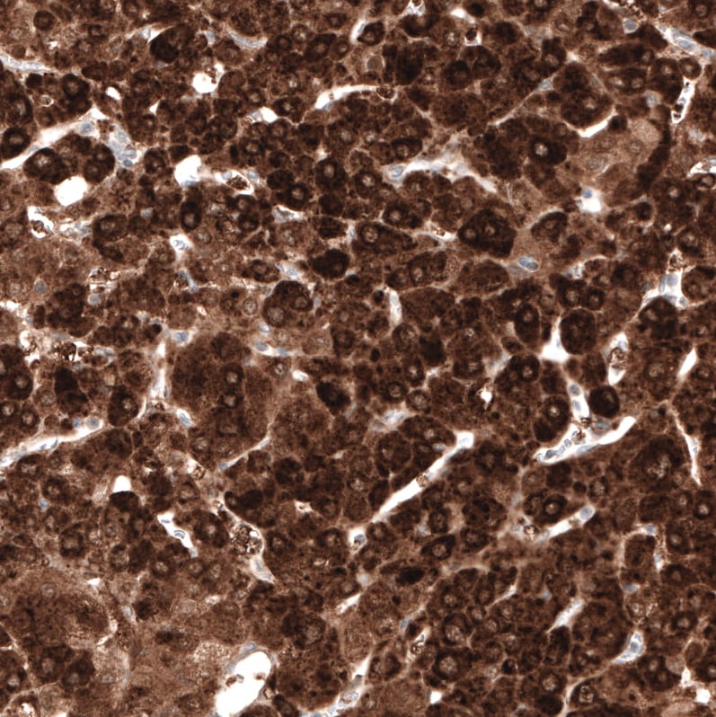 HMG-CoA Reductase/HMGCR Antibody (CL0259) Immunohistochemistry: HMG-CoA Reductase/HMGCR Antibody (CL0259) [NBP3-52446]