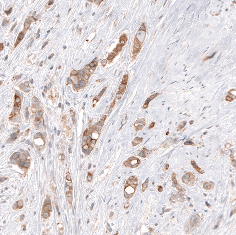 HMG-CoA Reductase/HMGCR Antibody (CL0259) Immunohistochemistry: HMG-CoA Reductase/HMGCR Antibody (CL0259) [NBP3-52446]