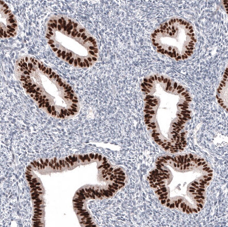 Pax2 Antibody (CL9469) Immunohistochemistry: Pax2 Antibody (CL9469) [NBP3-52485]