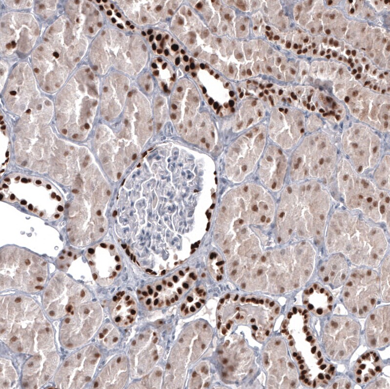 Pax2 Antibody (CL9469) Immunohistochemistry: Pax2 Antibody (CL9469) [NBP3-52485]