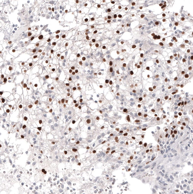 Pax2 Antibody (CL9469) Immunohistochemistry: Pax2 Antibody (CL9469) [NBP3-52485]