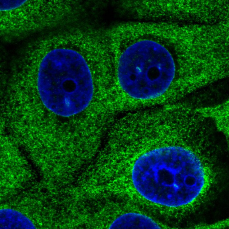 gp96/HSP90B1/GRP94 Antibody (CL2647) Immunocytochemistry/ Immunofluorescence: gp96/HSP90B1/GRP94 Antibody (CL2647) [NBP3-52460]