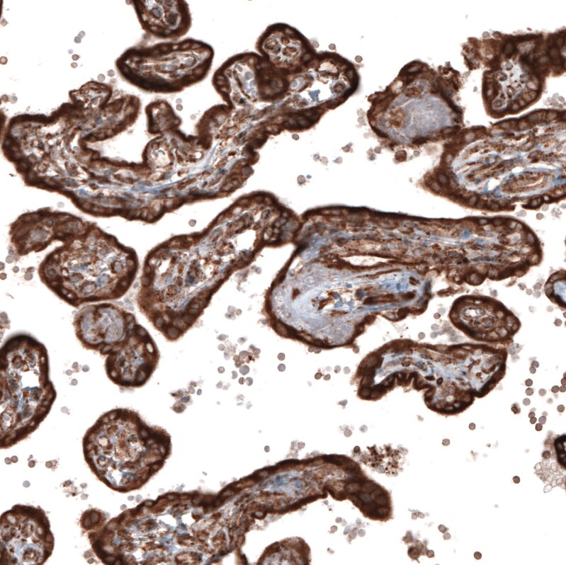 gp96/HSP90B1/GRP94 Antibody (CL2647) Immunohistochemistry: gp96/HSP90B1/GRP94 Antibody (CL2647) [NBP3-52460]