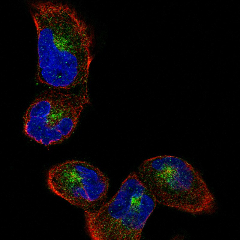 Sortilin Antibody (CL6526) Immunocytochemistry/ Immunofluorescence: Sortilin Antibody (CL6526) [NBP3-52483]