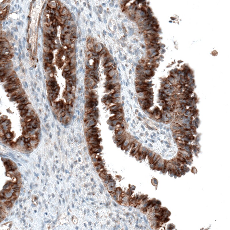 Sortilin Antibody (CL6526) Immunohistochemistry: Sortilin Antibody (CL6526) [NBP3-52483]