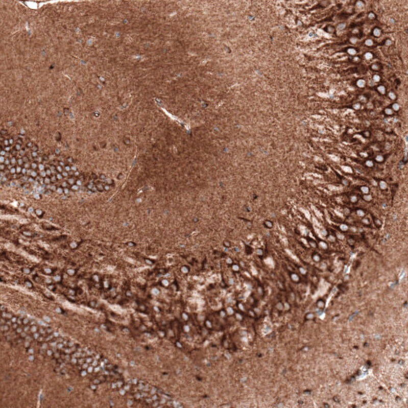 Sortilin Antibody (CL6526) Immunohistochemistry: Sortilin Antibody (CL6526) [NBP3-52483]