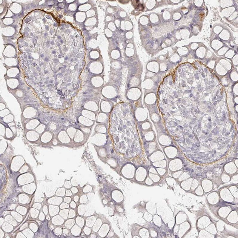 LAMC2 Antibody (CL2980) Immunohistochemistry: LAMC2 Antibody (CL2980) [NBP3-52101]