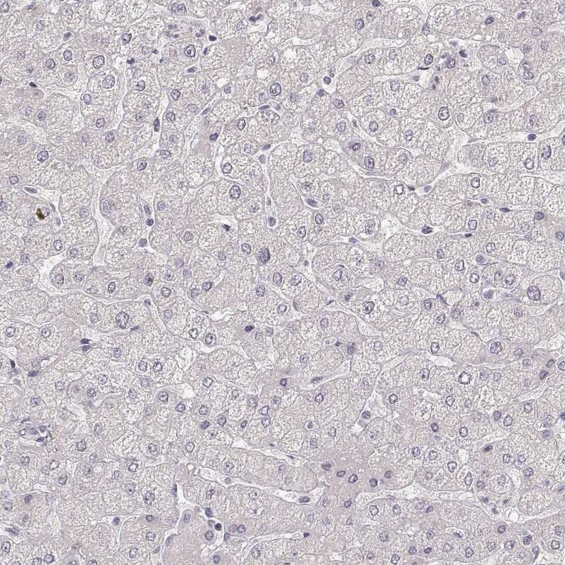 LAMC2 Antibody (CL2980) Immunohistochemistry: LAMC2 Antibody (CL2980) [NBP3-52101]