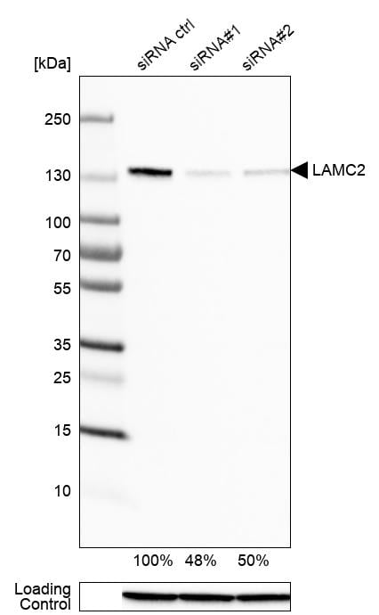 LAMC2 Antibody (CL2980) Western Blot: LAMC2 Antibody (CL2980) [NBP3-52101]