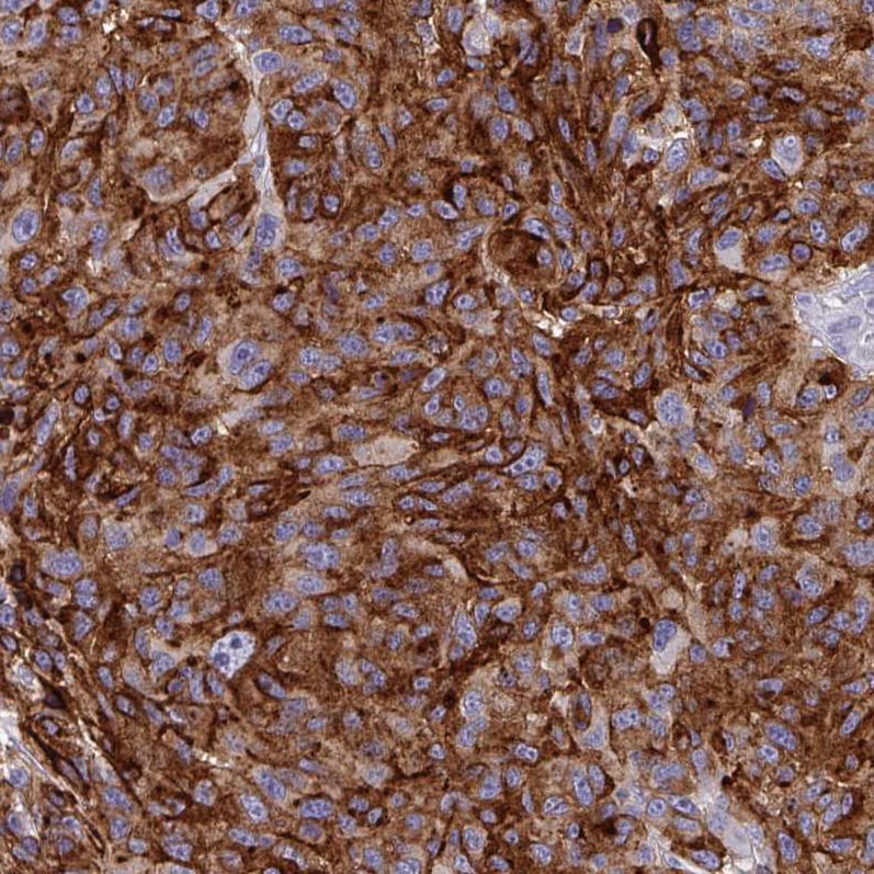 Syntaxin 7 Antibody (CL0257) Immunohistochemistry: Syntaxin 7 Antibody (CL0257) [NBP3-52102]