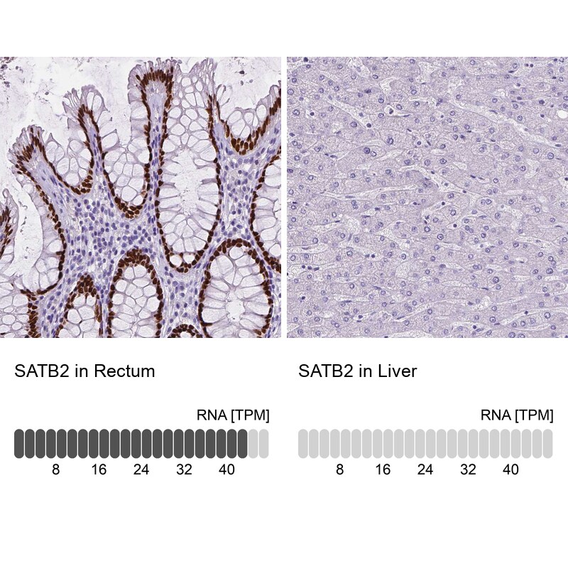 SATB2 Antibody (CL0320) Immunohistochemistry: SATB2 Antibody (CL0320) [NBP3-52448]