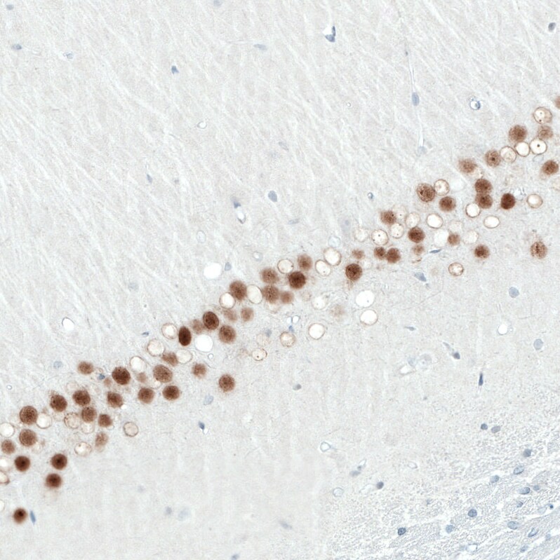 SATB2 Antibody (CL0320) Immunohistochemistry: SATB2 Antibody (CL0320) [NBP3-52448]