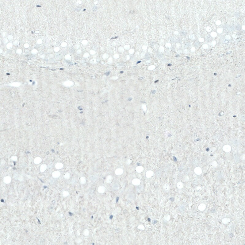 SATB2 Antibody (CL0320) Immunohistochemistry: SATB2 Antibody (CL0320) [NBP3-52448]