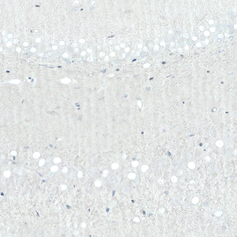 SATB2 Antibody (CL0320) Immunohistochemistry: SATB2 Antibody (CL0320) [NBP3-52103]