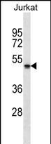 NBPF5 Antibody (RB31222)