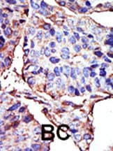 BGLF4 Antibody (RB3734)