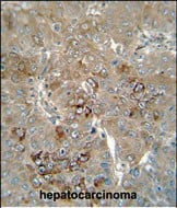CES1P1 Antibody (RB23181)
