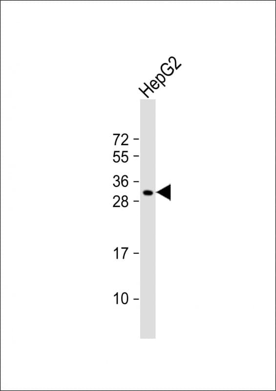CES1P1 Antibody (RB23181)