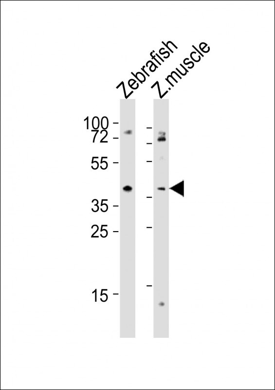 aplnra Antibody (RB52055)