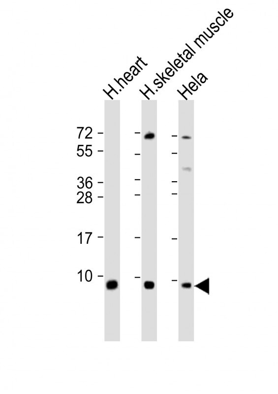 ATP5E Antibody (RB53868)