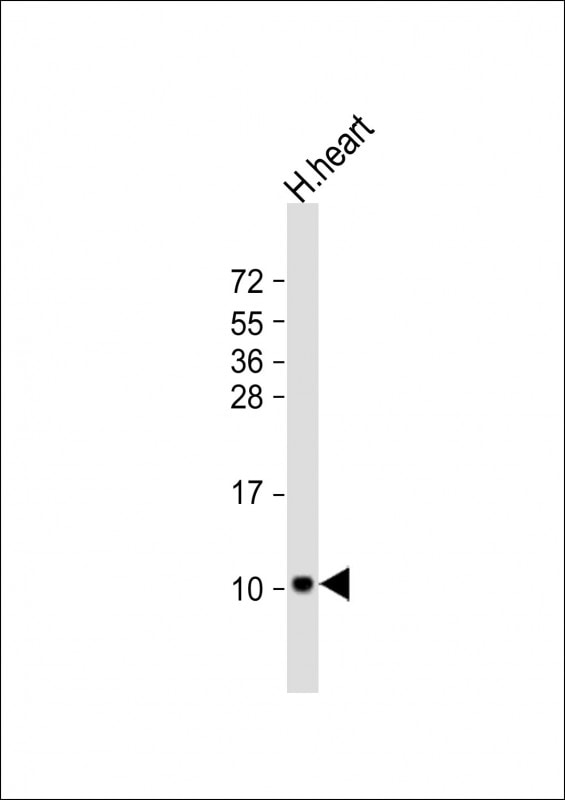 ATP5F1EP2 Antibody (RB53889)