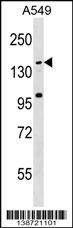 CCDC144CP Antibody (RB38721)